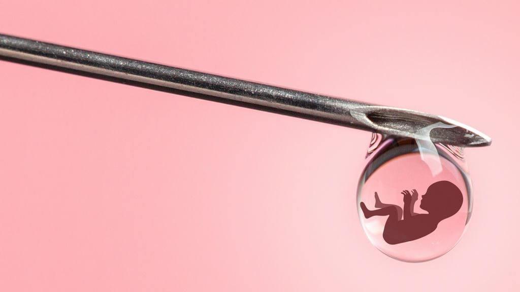 نجاح الحقن المجهري في الأردن